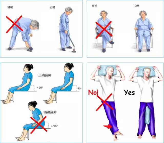 髋关节置换术后的康复训练方案
